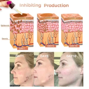 2025s,NESLEMY™ Fast Dark Spot Remover ✨ Where science meets luxury. Our melanin-correcting serum erase