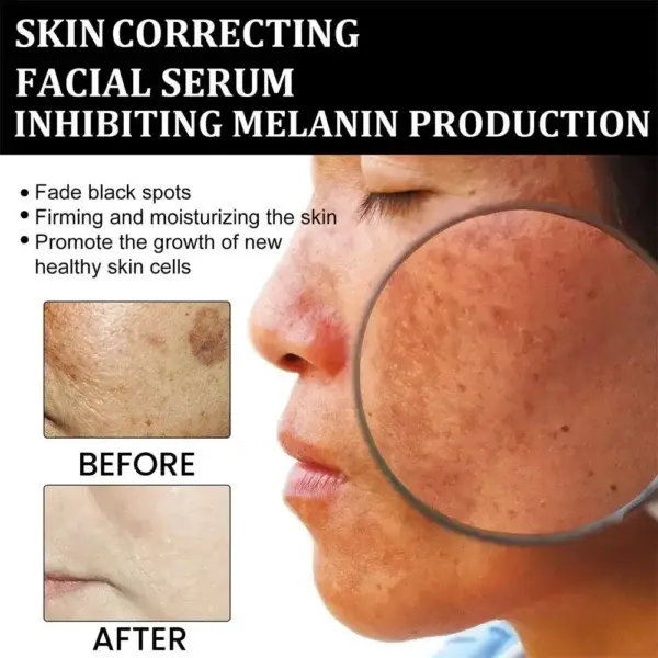 NESLEMY™ Fast Dark Spot Remover