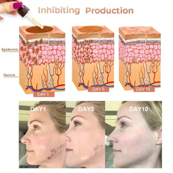 NESLEMY™ Fast Dark Spot Remover