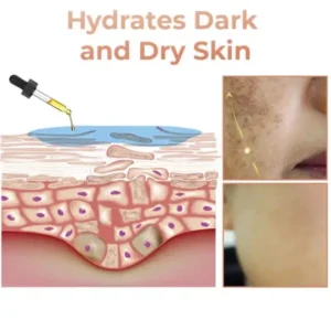 NESLEMY™ Fast Dark Spot Remover