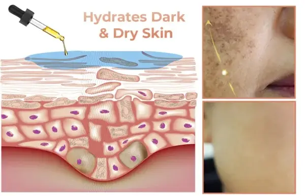 NESLEMY™ Fast Dark Spot Remover