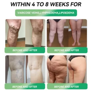 🎄 Christmas Sale: Buy 5 Get 5 Free | Cvreoz®  6-in-1 Metabolism & Vitality Drops | Results in 7 Days ⚡