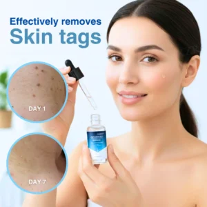 🏷️ EXCLUSIVE DEAL! 50% OFF - Cvreoz® Advanced Skin Tag & Wart Removal Essence (Copy)