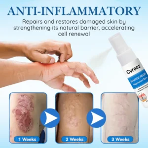 🏷️ EXCLUSIVE DEAL! 64% OFF - Cvreoz® Source-Relief Magnesium Spray (Copy)