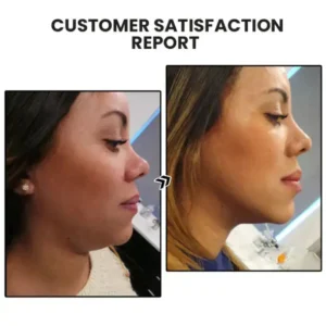 🎁 NESLEMY™ Limited-Time Offer: 60% Off! 🌲 Histone Lymphatic Magnetic Therapy Germanium Earrings 😍