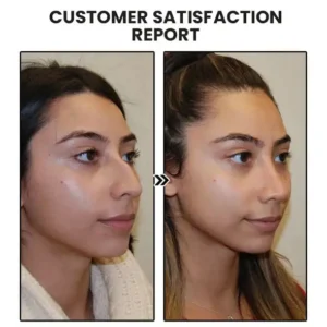 🎁 NESLEMY™ Limited-Time Offer: 60% Off! 🌲 Histone Lymphatic Magnetic Therapy Germanium Earrings 😍