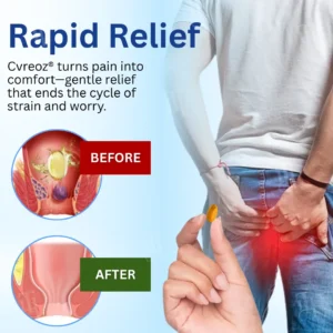 Cvreoz® Natural Herbs Strength Hemorrhoids Capsules